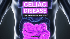 Diagram of the intestines serving as a guide to the regions impacted by celiac disease.